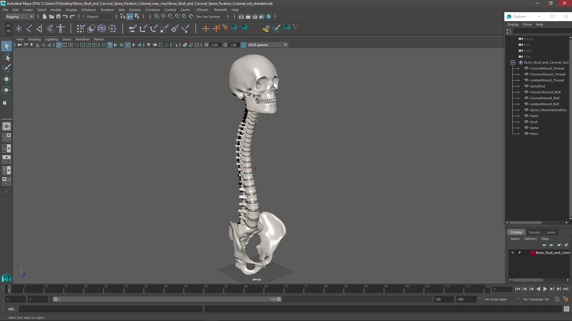 3D Bone Skull and Cervical Spine Fixation Colored