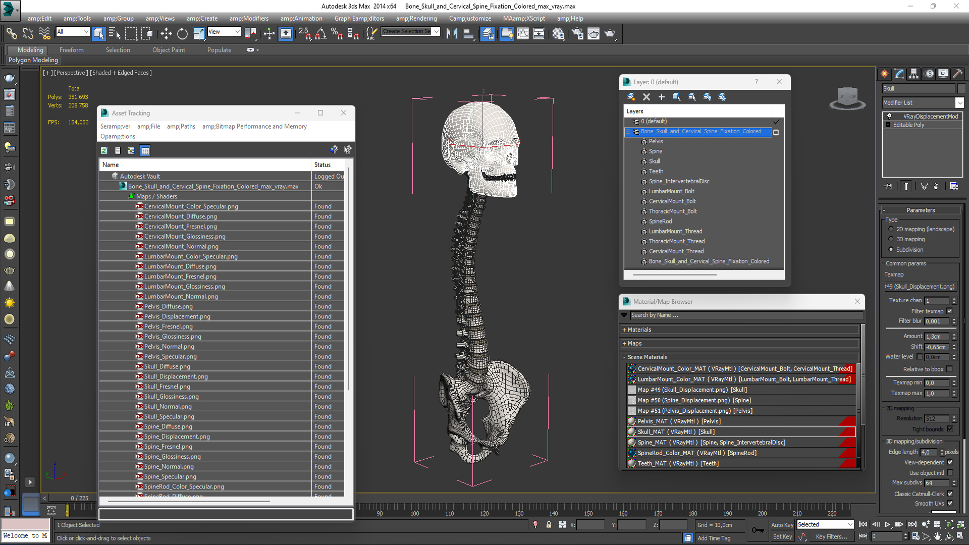 3D Bone Skull and Cervical Spine Fixation Colored