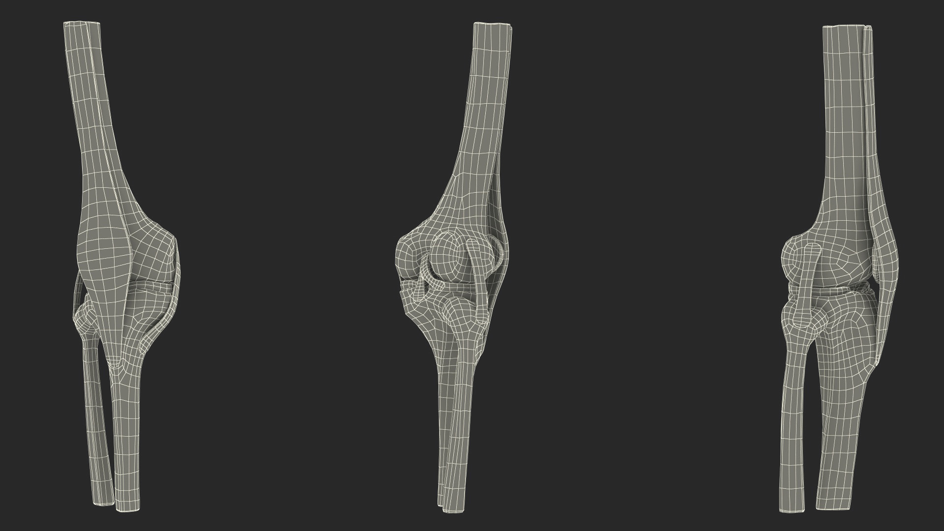 Knee Joint Model Unbent State 3D model