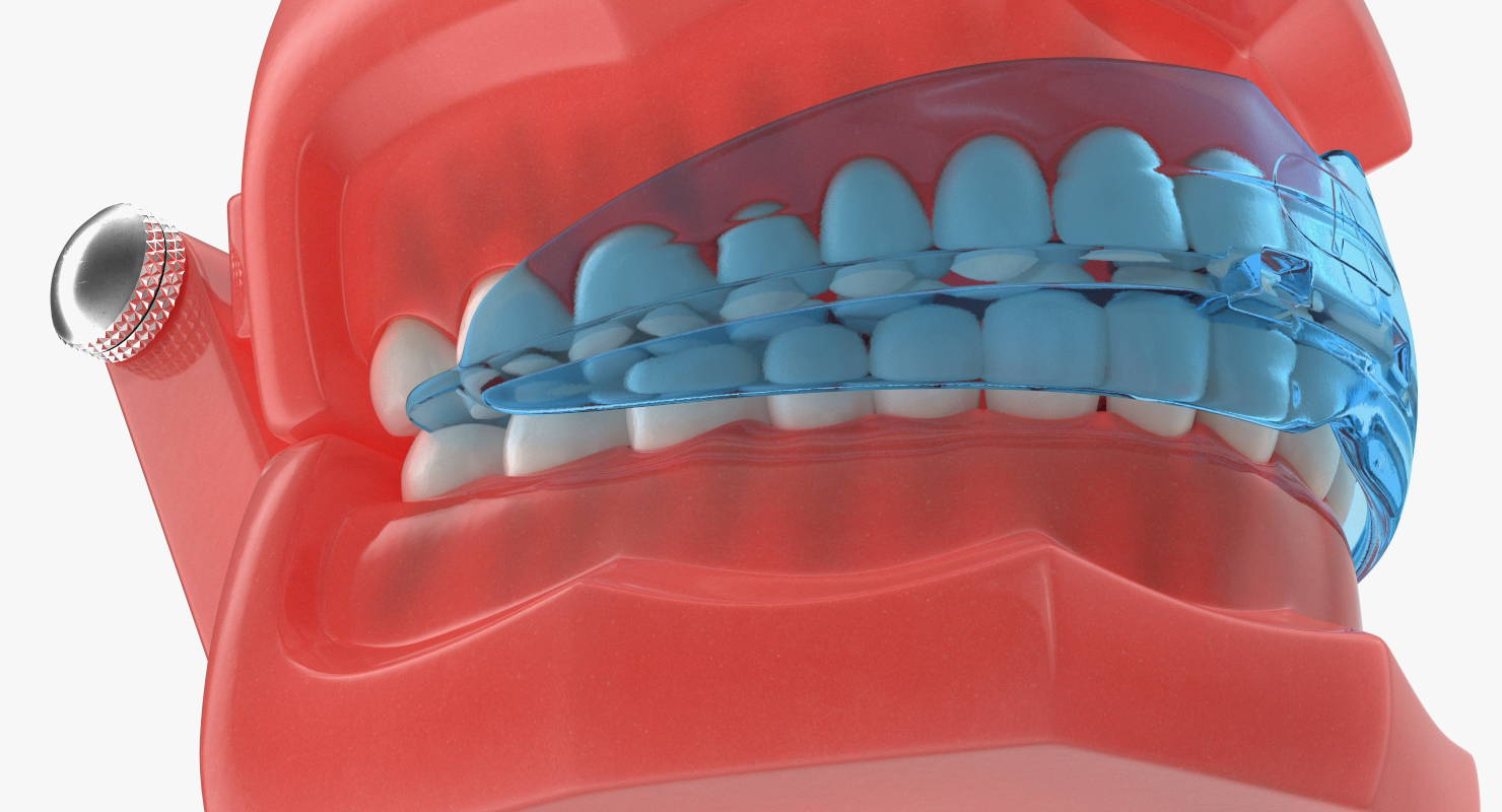 Typodont with Transparent Removable Retainer 3D model