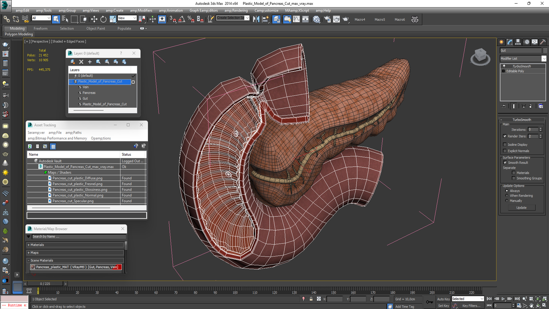 Plastic Model of Pancreas Cut 3D model