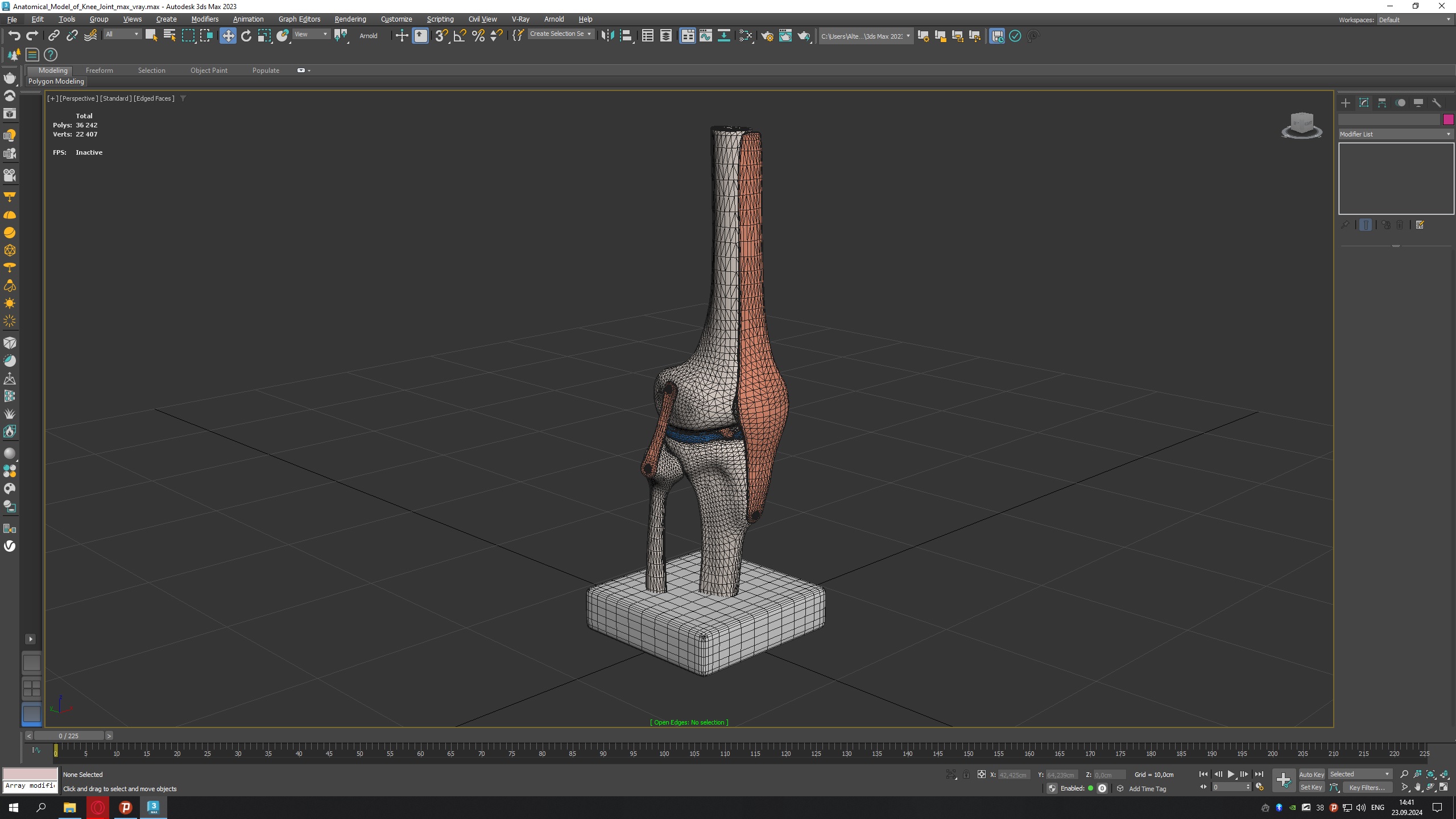 3D Anatomical Model of Knee Joint for 3D Print model