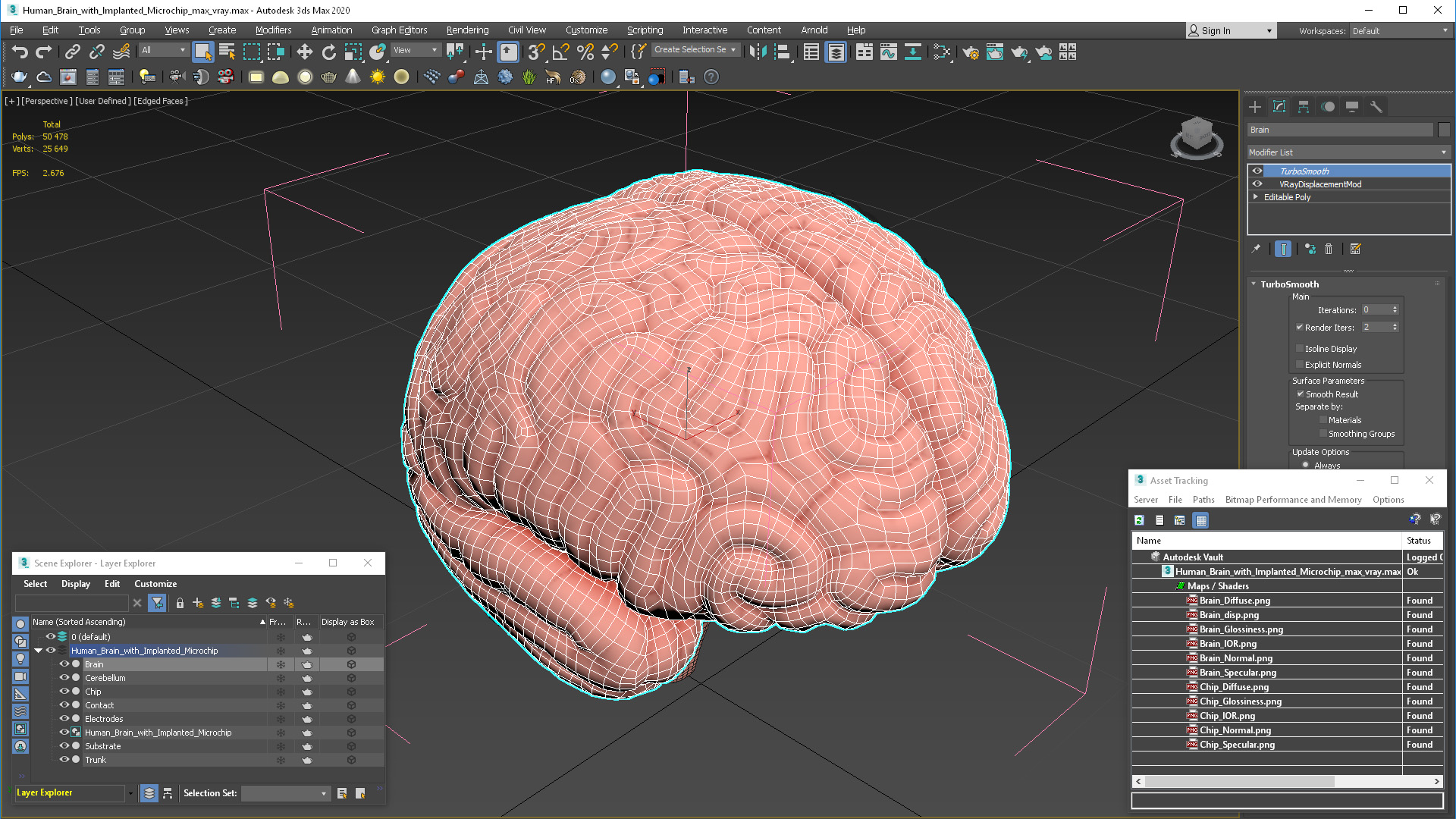 3D Human Brain with Implanted Microchip