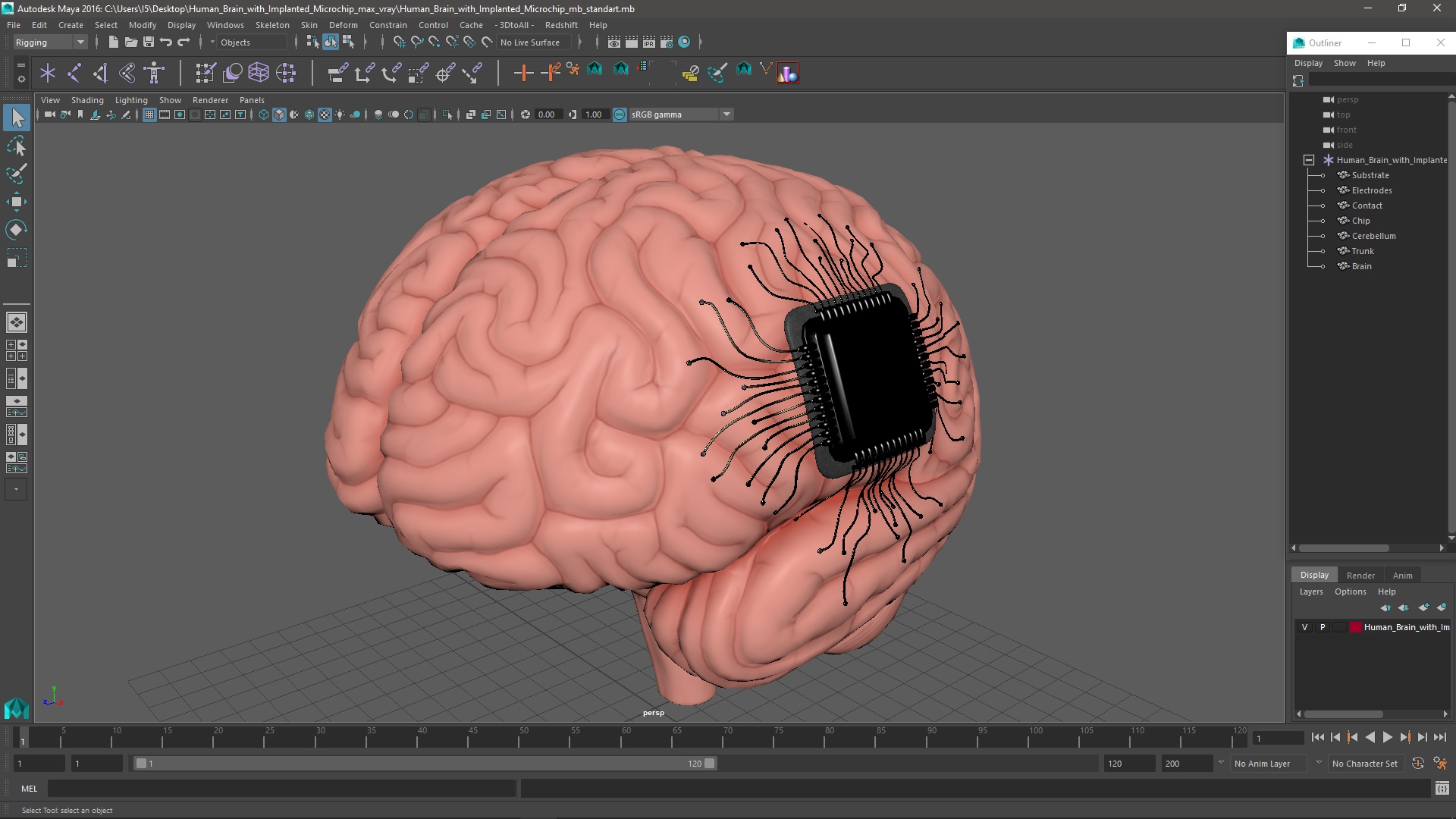 3D Human Brain with Implanted Microchip
