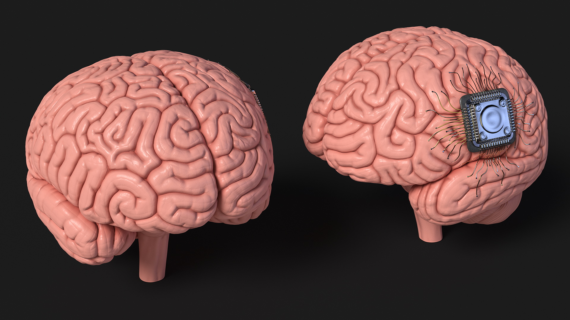 3D Human Brain with Implanted Microchip