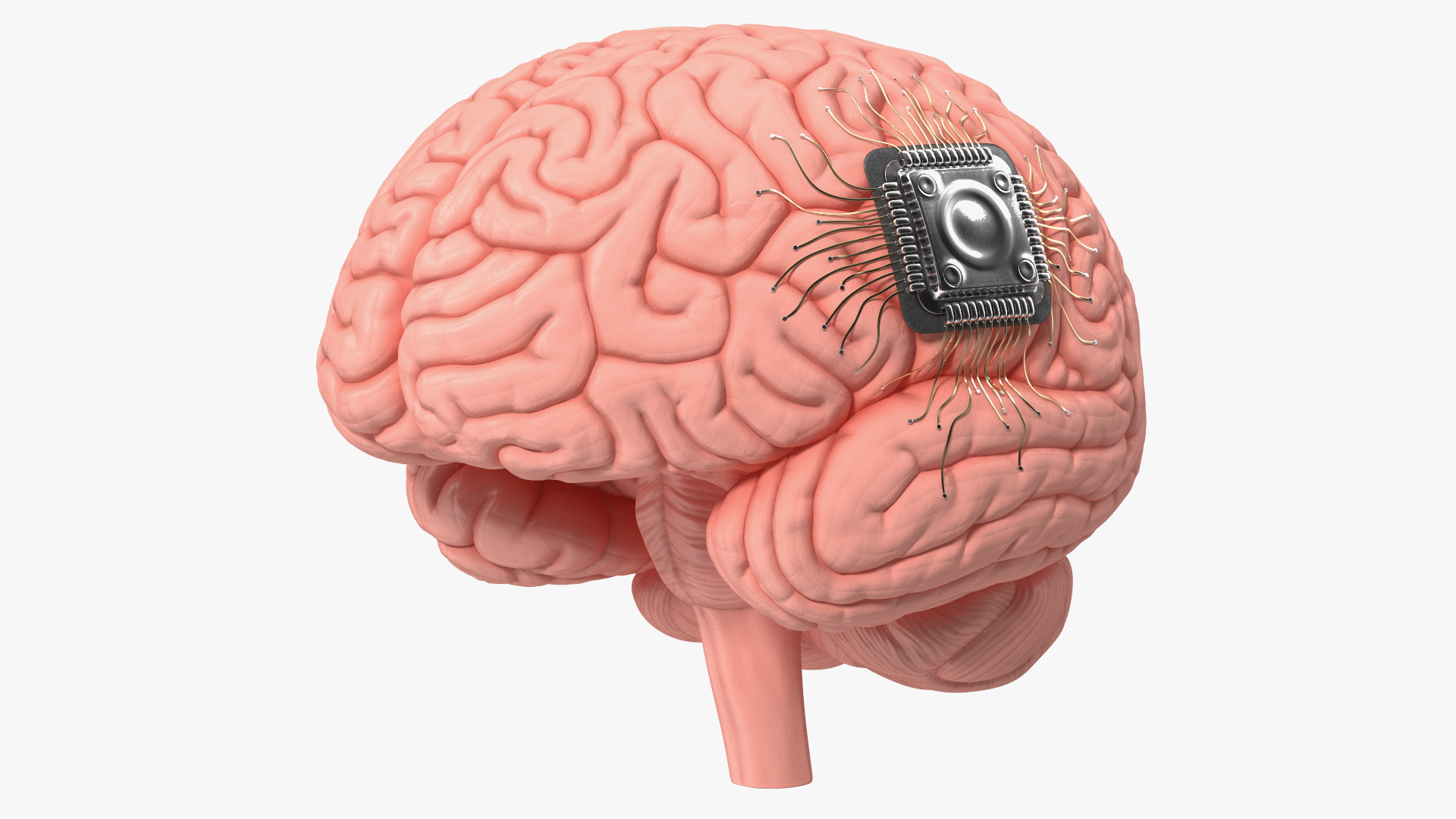 3D Human Brain with Implanted Microchip