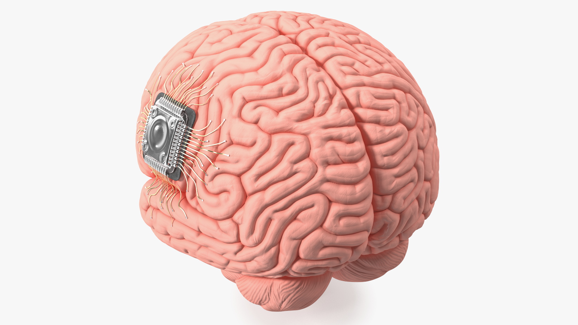 3D Human Brain with Implanted Microchip