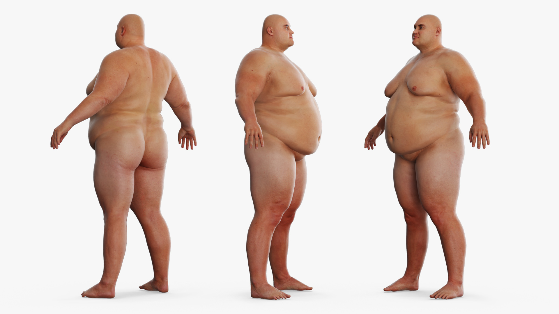 Patient Gown on Heavyset Man - view 6