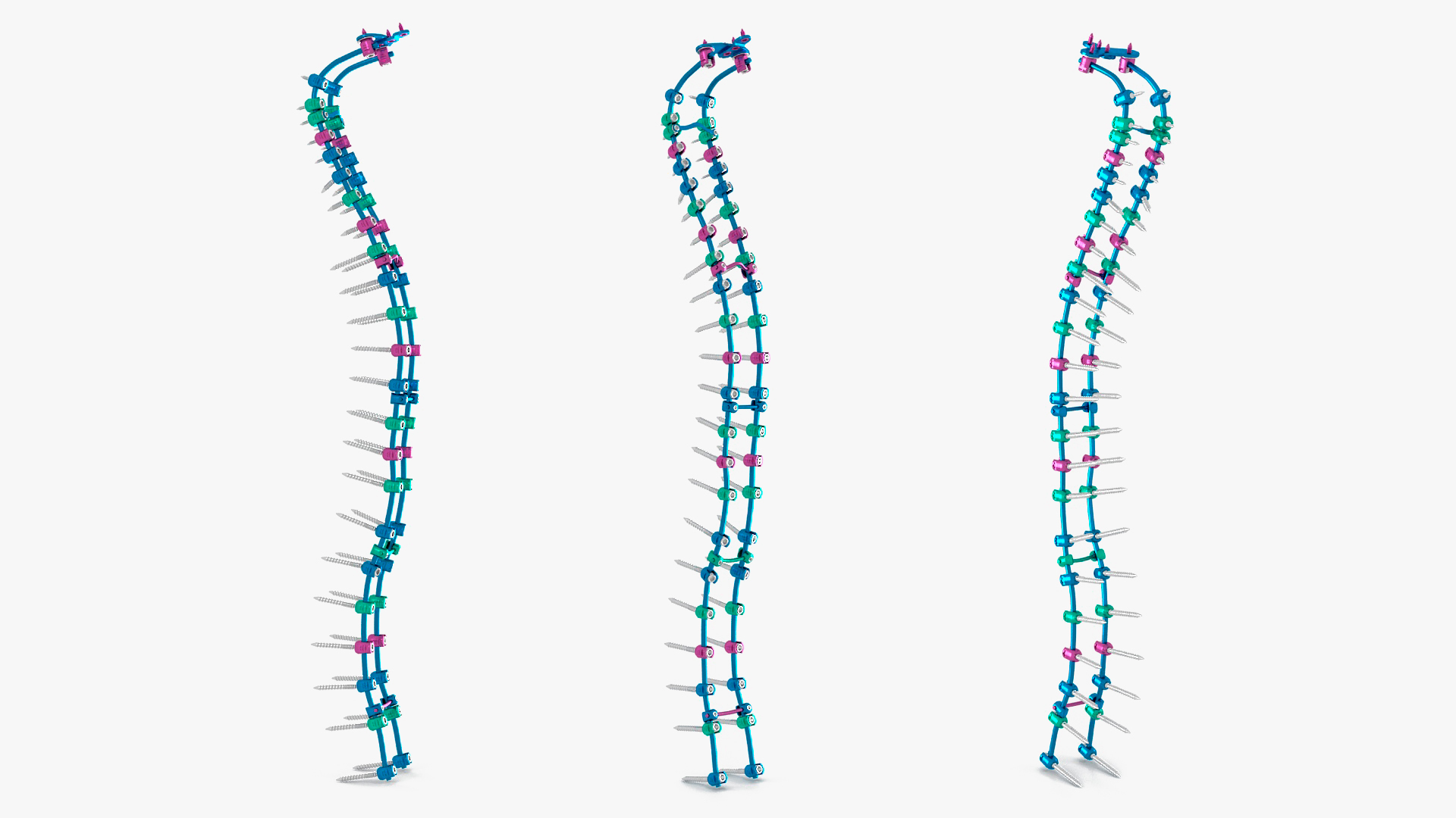 Spine Fixation System Colored 3D model