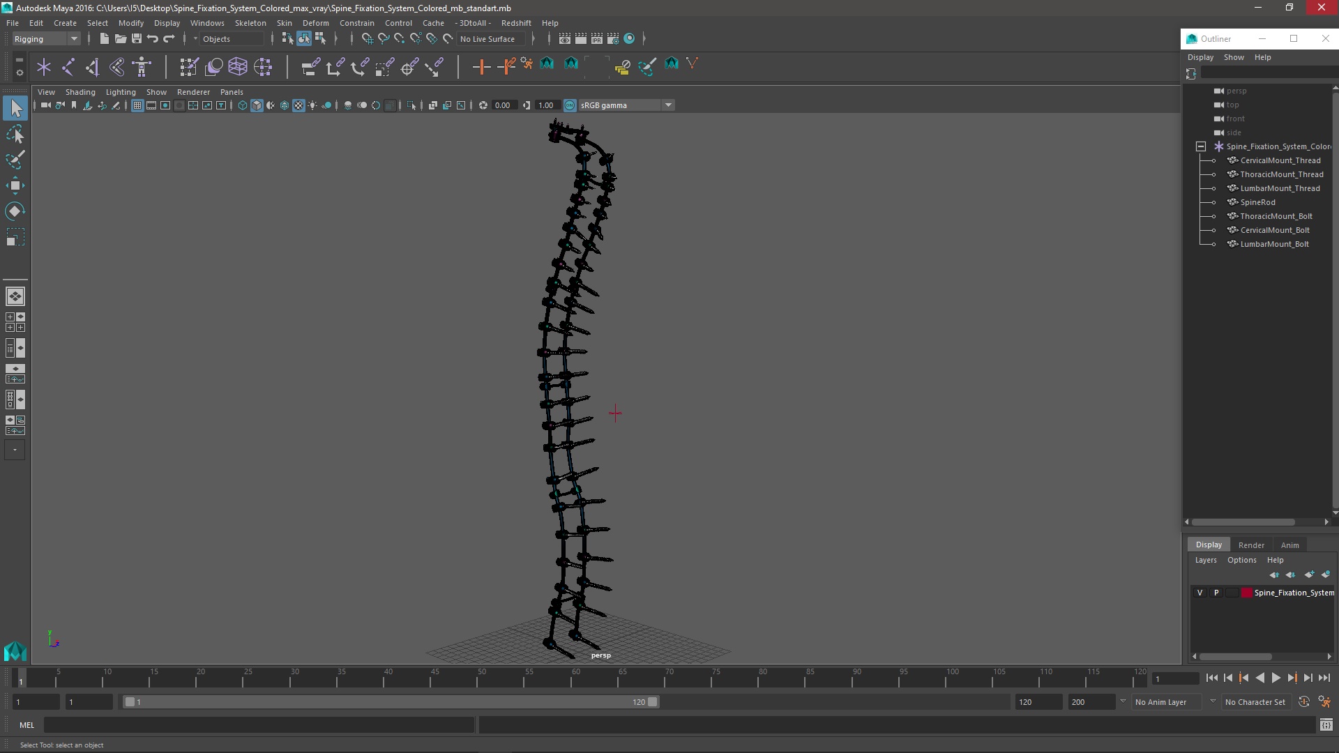 Spine Fixation System Colored 3D model