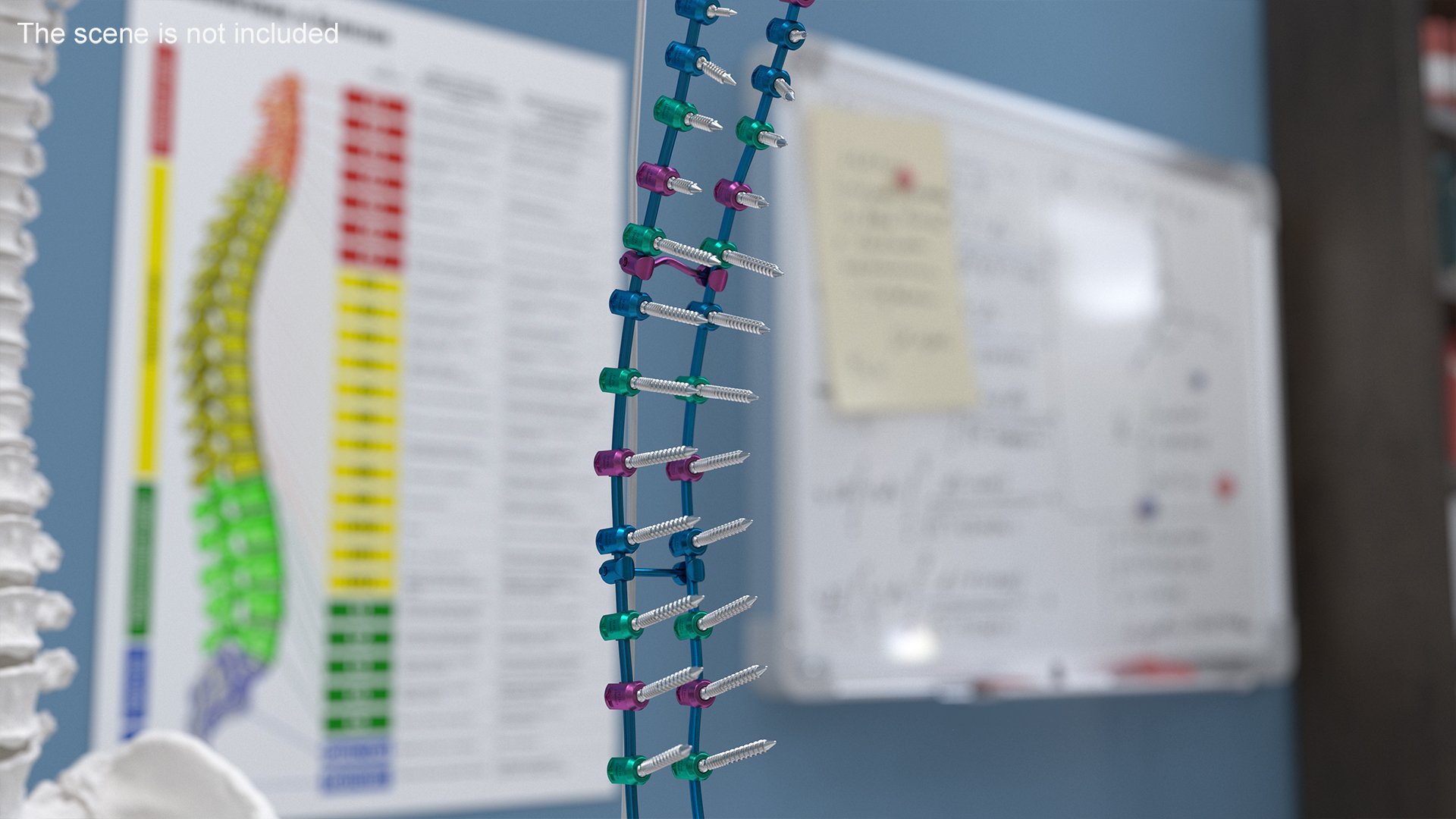 Spine Fixation System Colored 3D model
