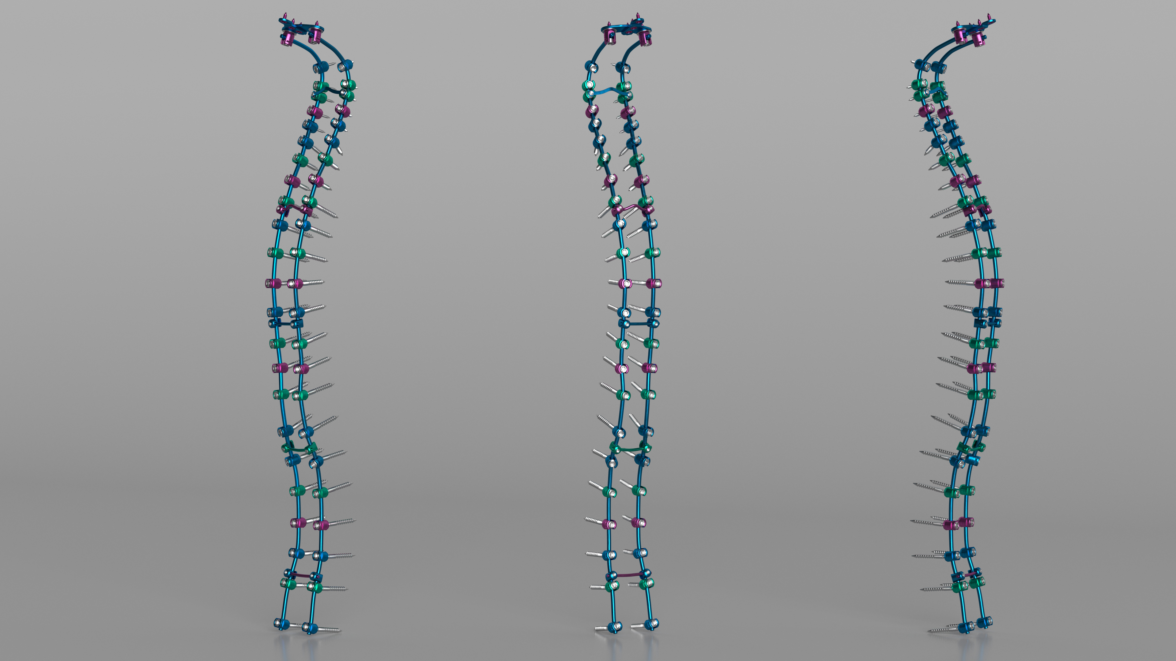 Spine Fixation System Colored 3D model