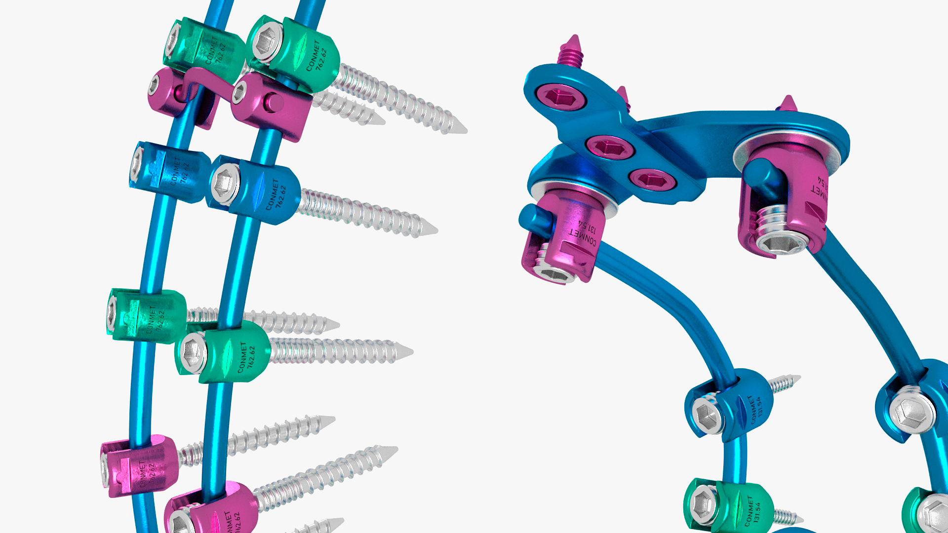 Spine Fixation System Colored 3D model