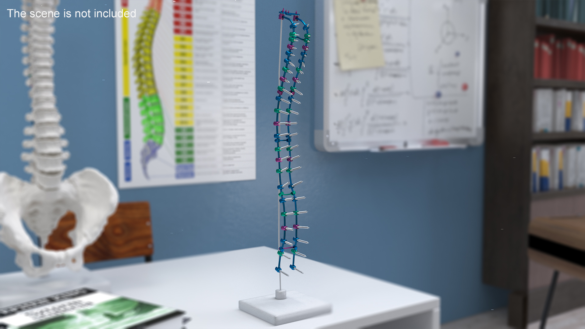 Spine Fixation System Colored 3D model