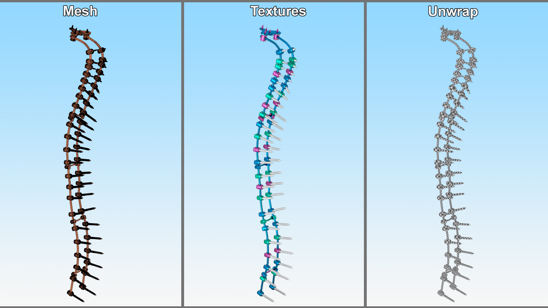 Spine Fixation System Colored 3D model