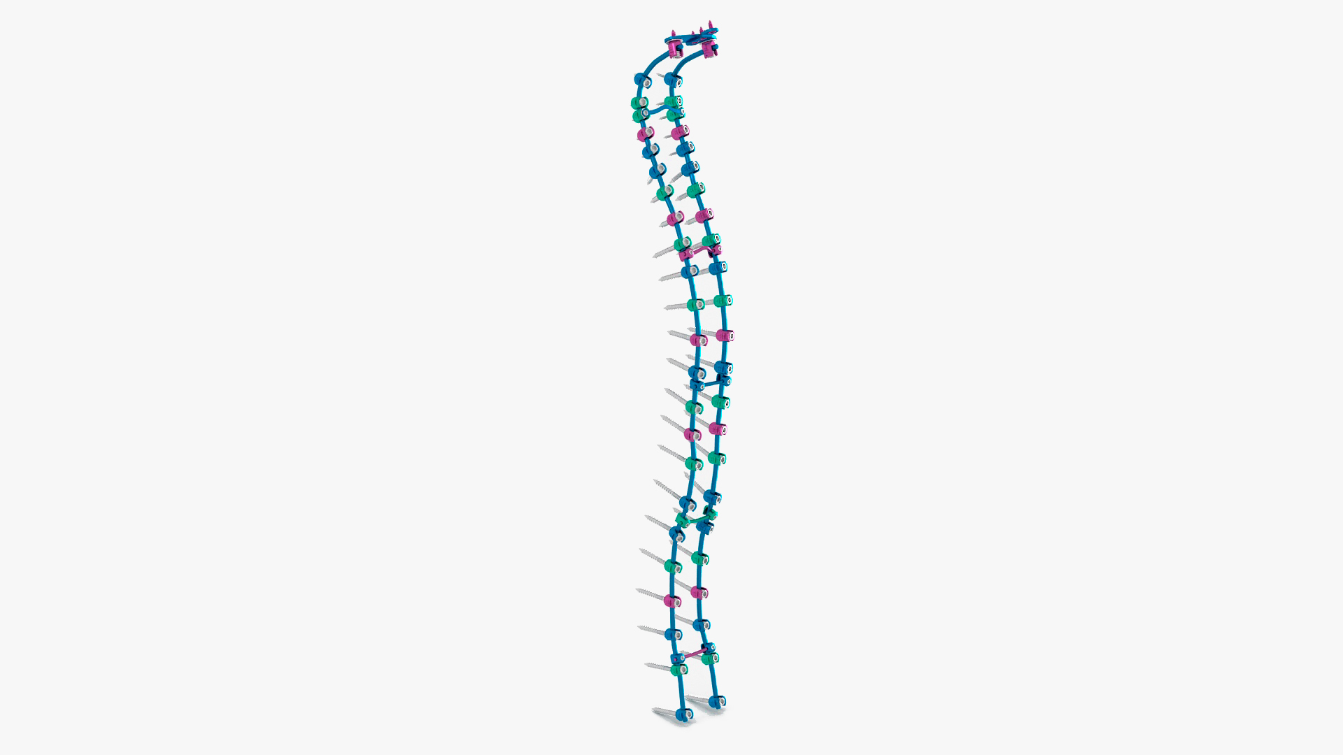 Spine Fixation System Colored 3D model