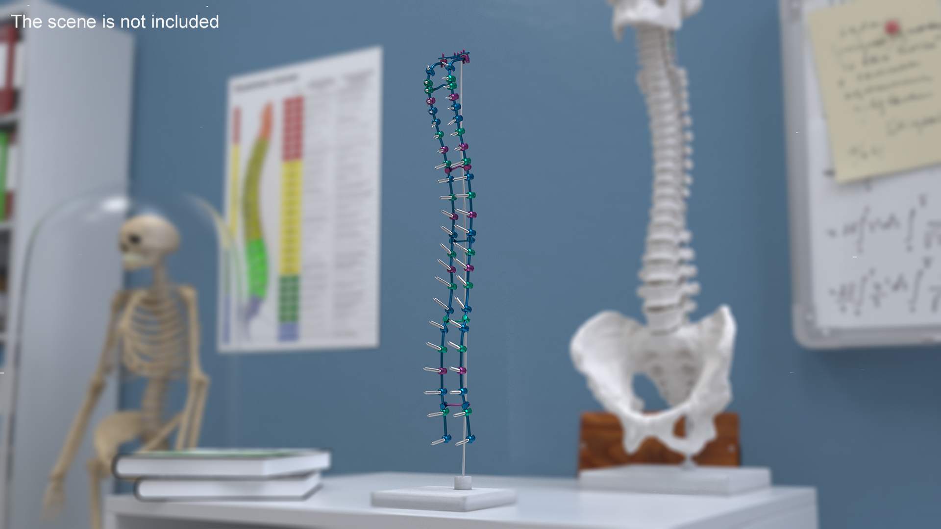 Spine Fixation System Colored 3D model