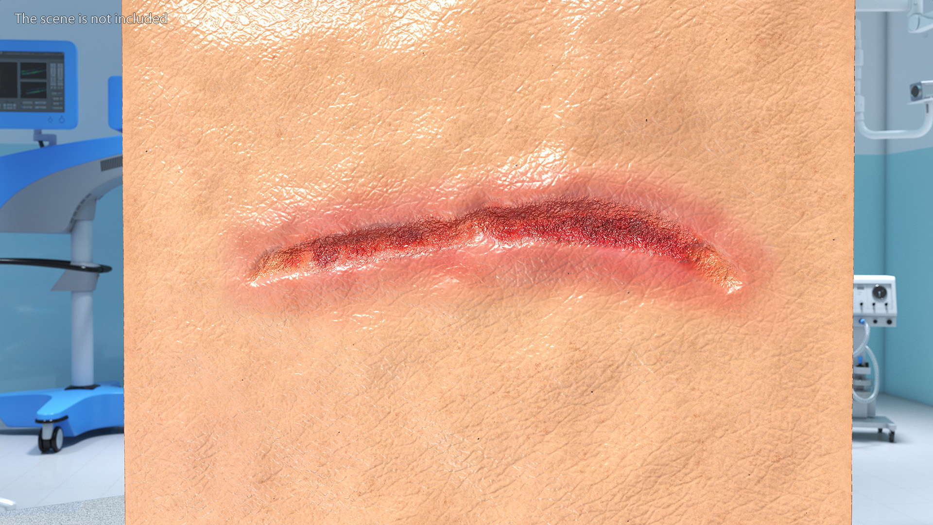 3D Cut Skin Surface