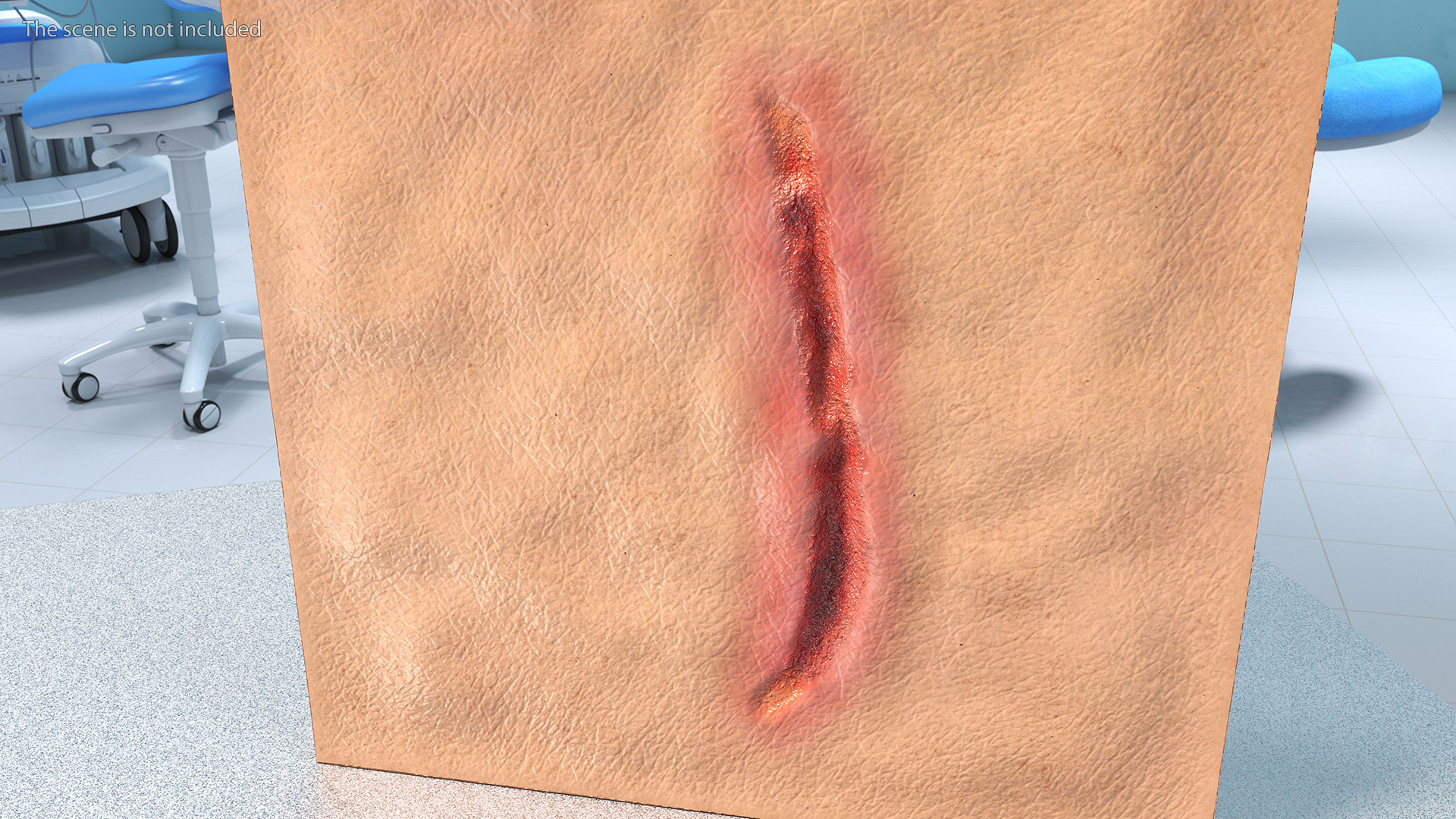 3D Cut Skin Surface
