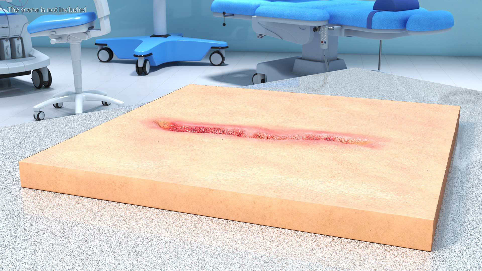 3D Cut Skin Surface