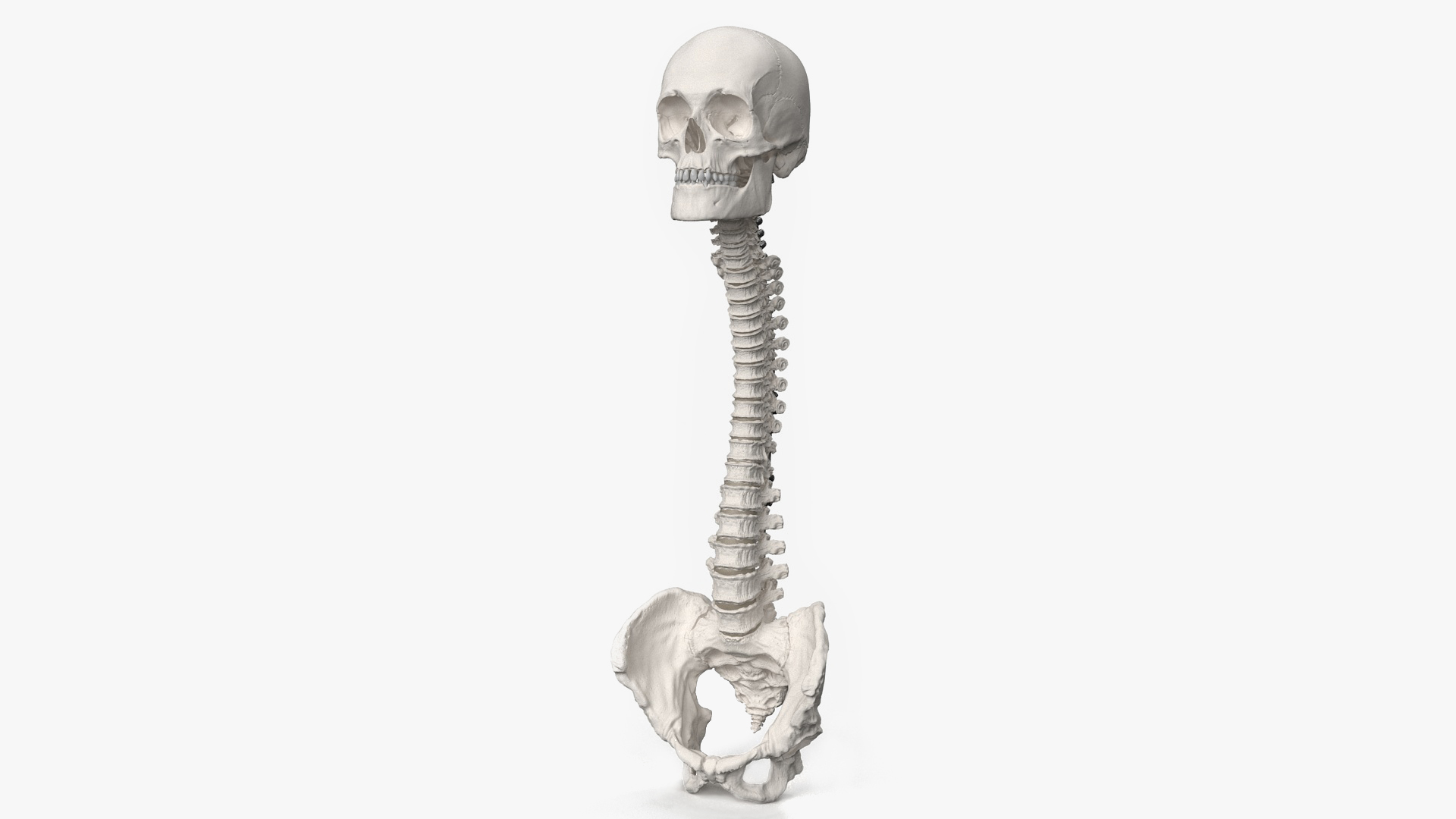 3D Bone Skull and Cervical Spine Fixation model