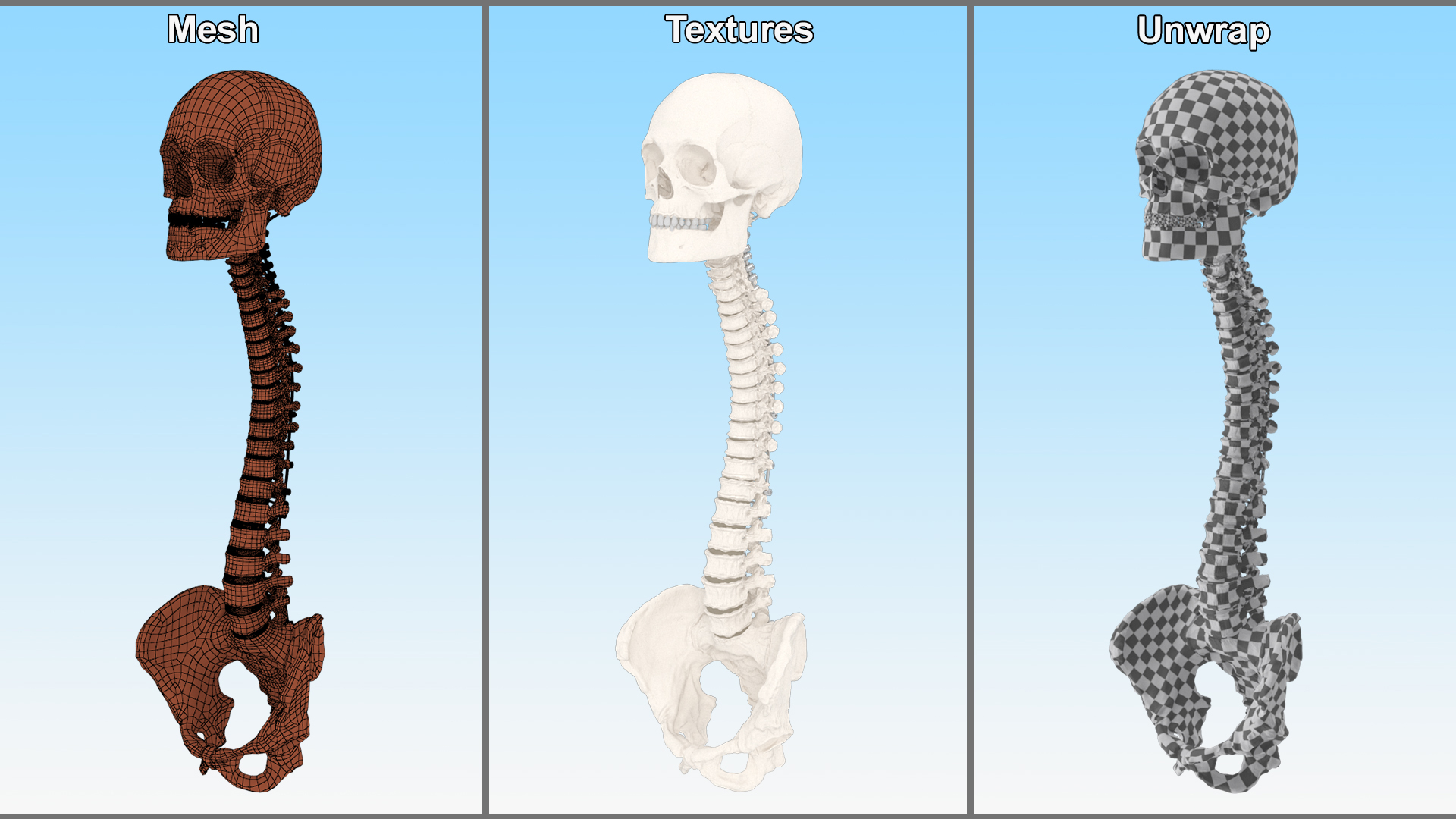 3D Bone Skull and Cervical Spine Fixation model