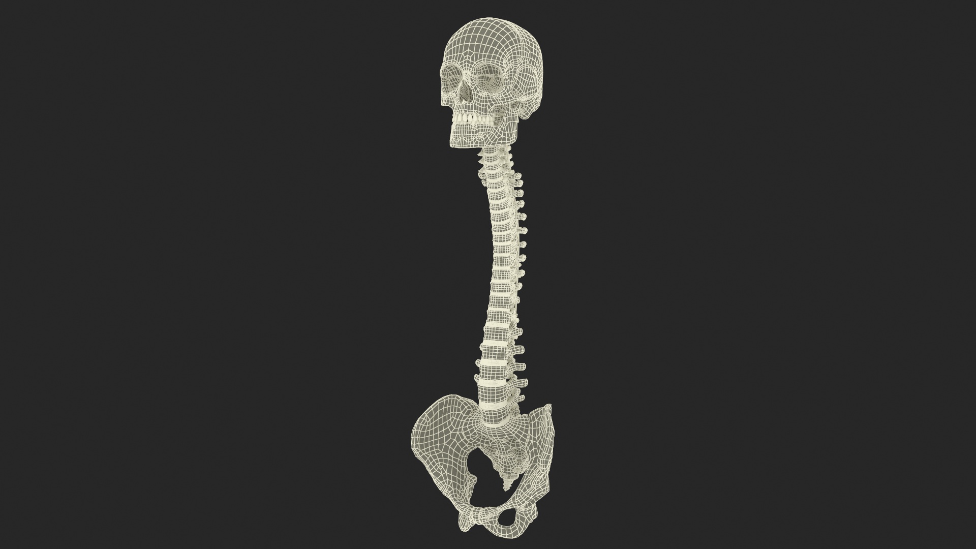 3D Bone Skull and Cervical Spine Fixation model