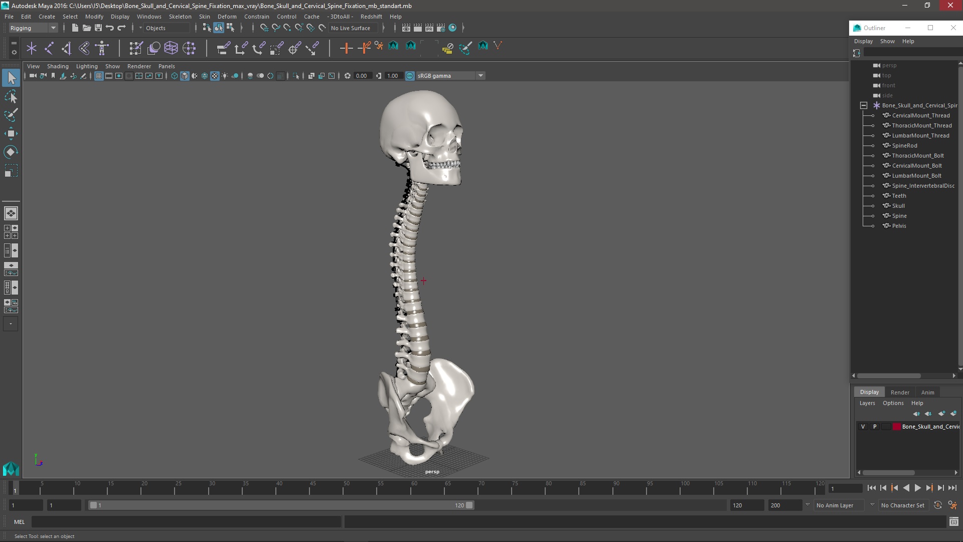 3D Bone Skull and Cervical Spine Fixation model