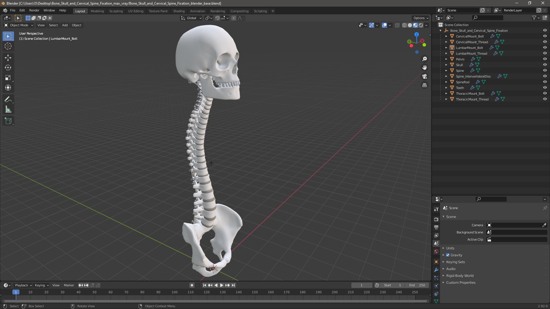 3D Bone Skull and Cervical Spine Fixation model