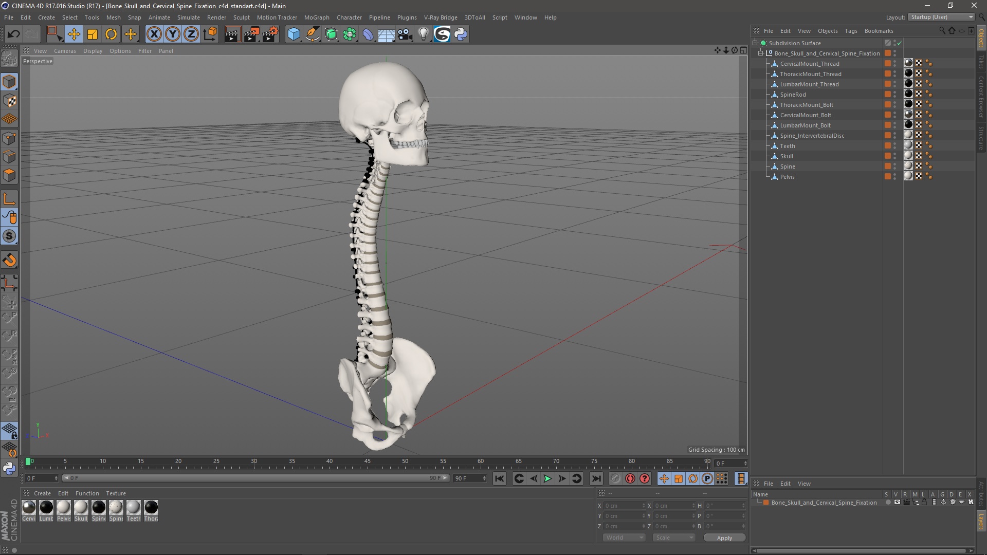 3D Bone Skull and Cervical Spine Fixation model