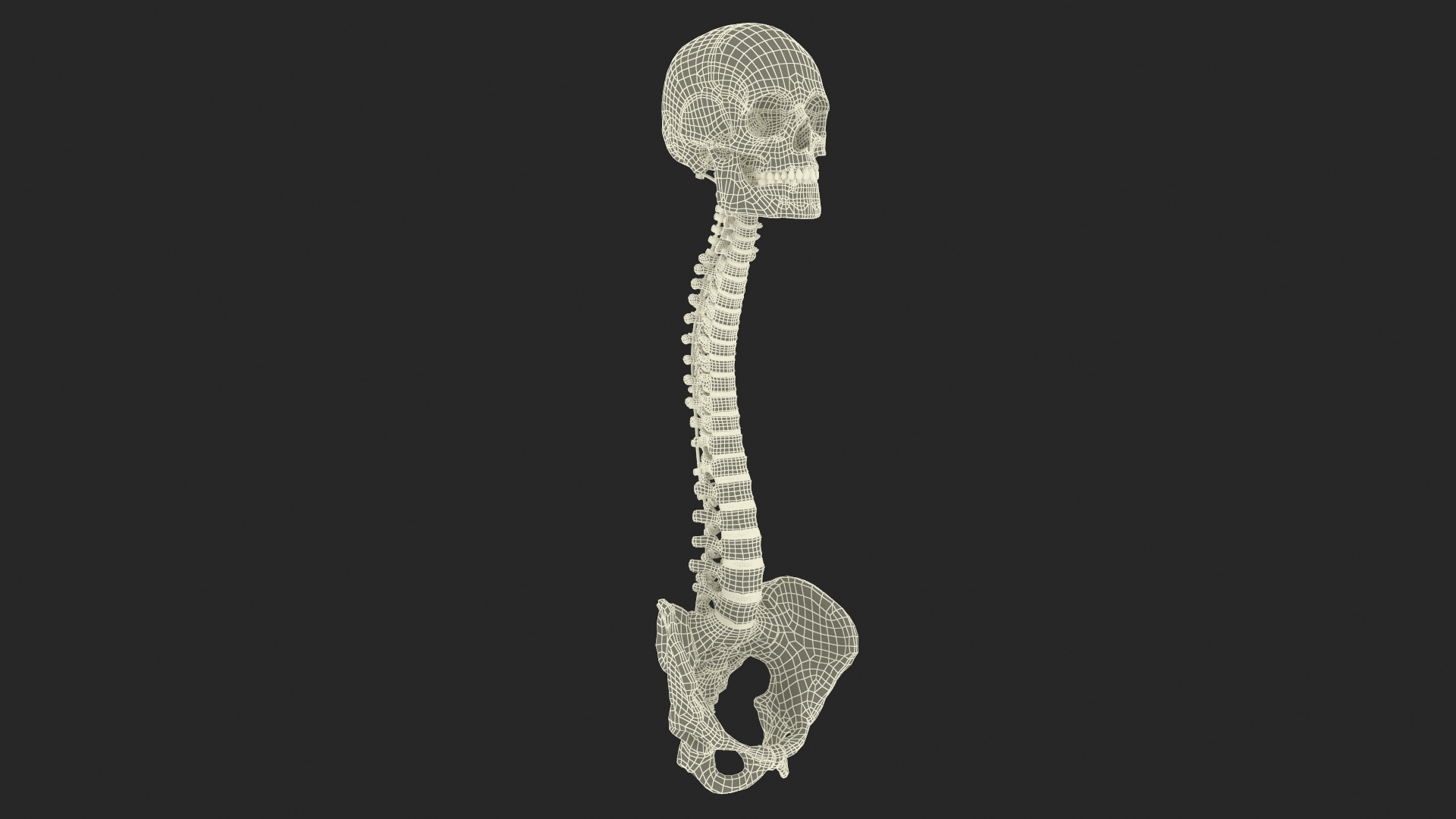 3D Bone Skull and Cervical Spine Fixation model