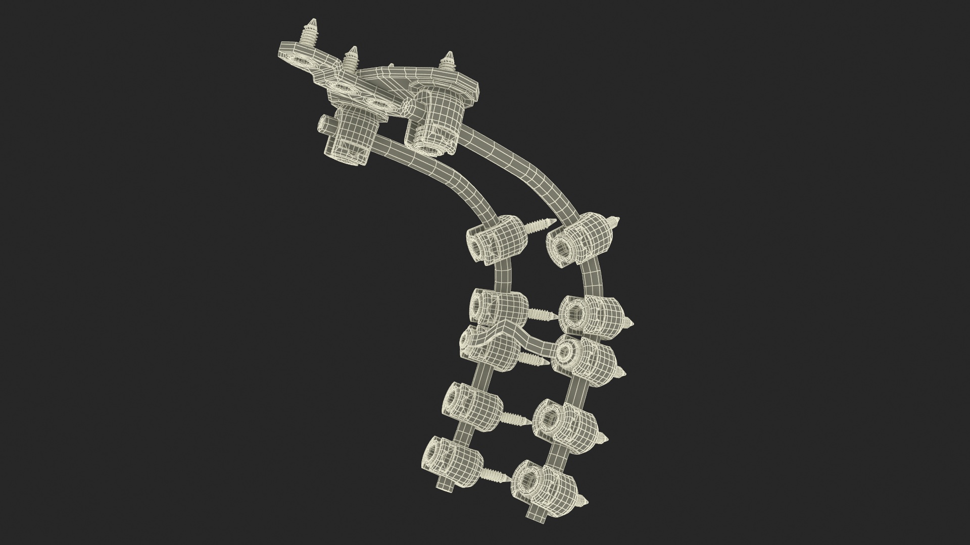 3D Posterior Cervical Spine Fixation System Colored model