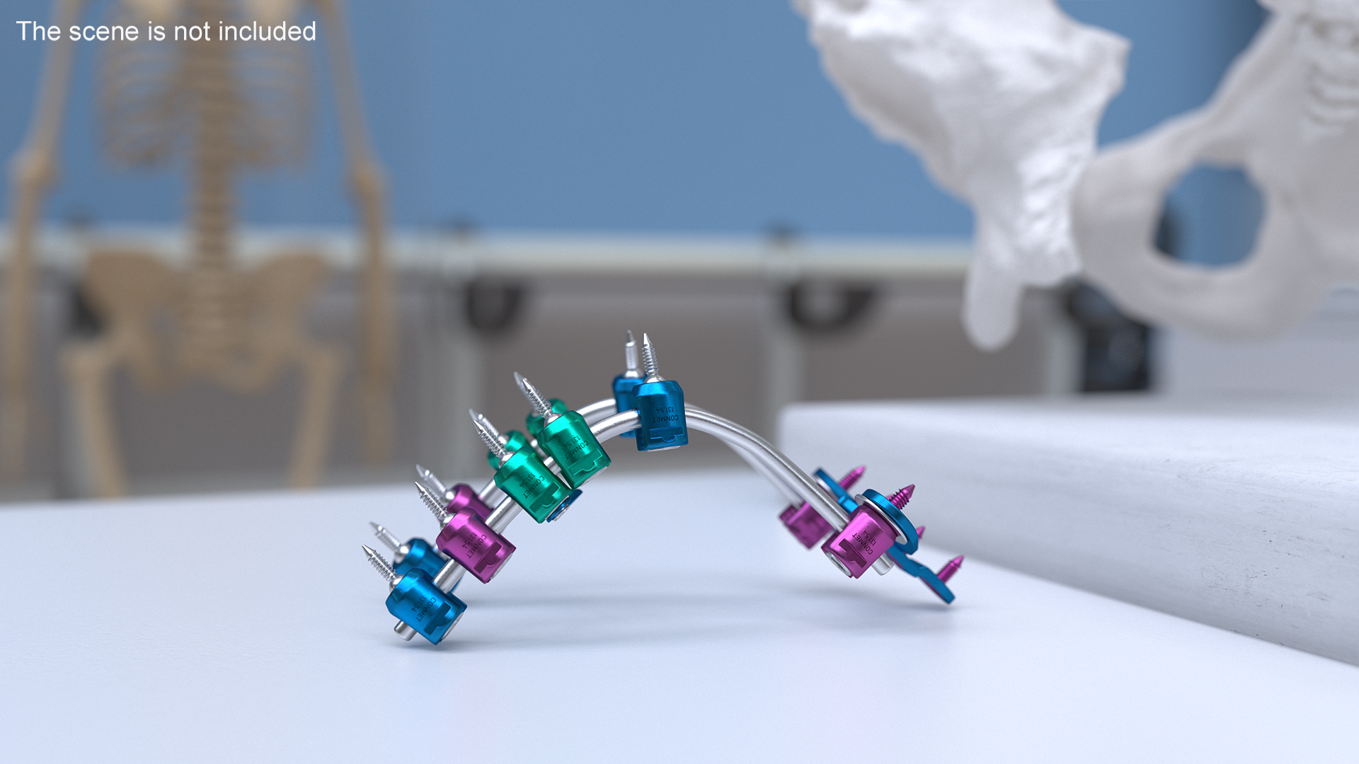3D Posterior Cervical Spine Fixation System Colored model