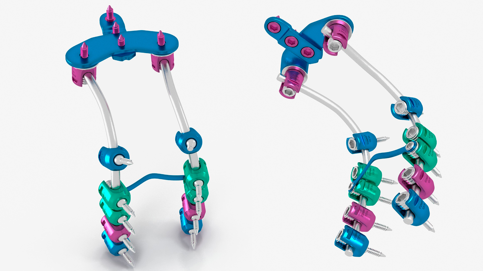 3D Posterior Cervical Spine Fixation System Colored model