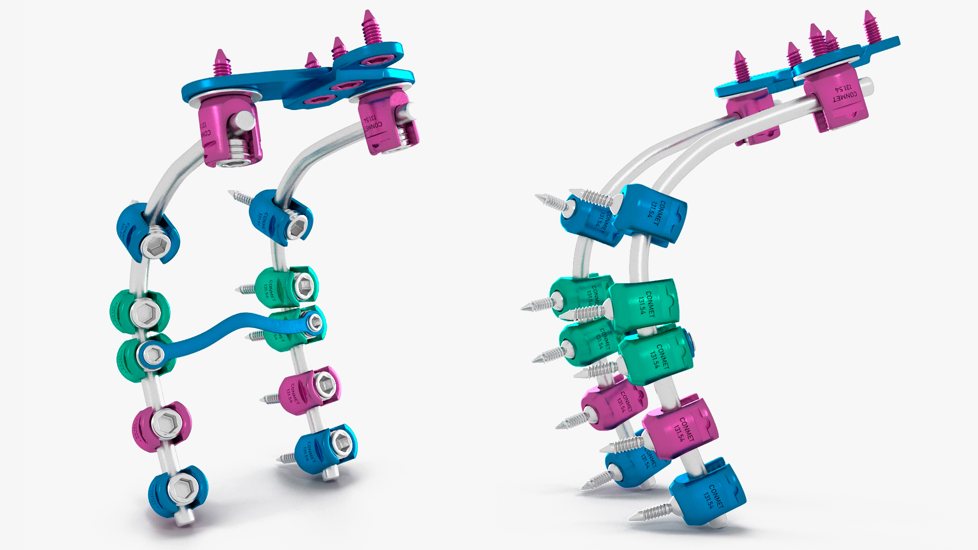 3D Posterior Cervical Spine Fixation System Colored model