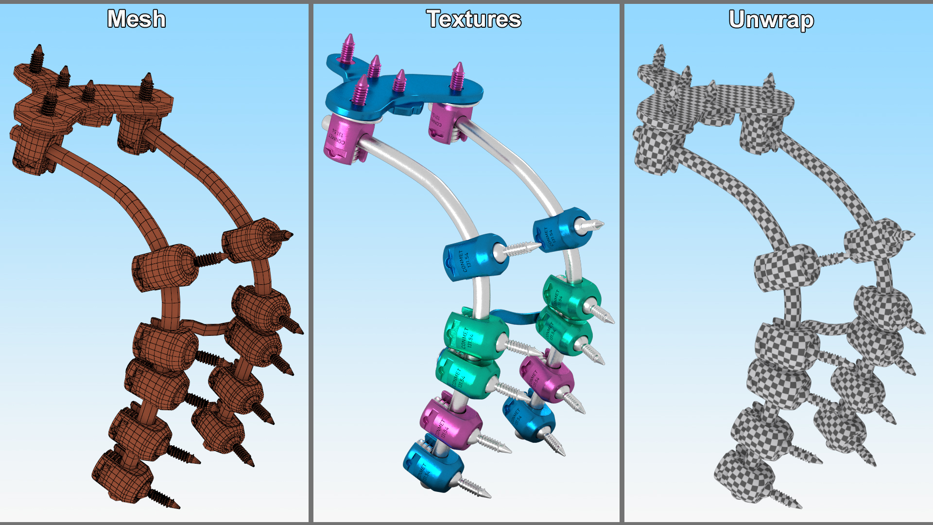 3D Posterior Cervical Spine Fixation System Colored model
