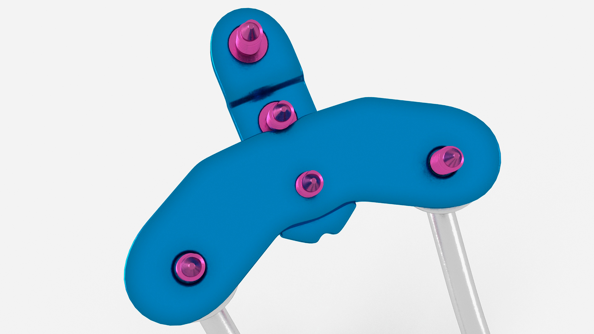 3D Posterior Cervical Spine Fixation System Colored model