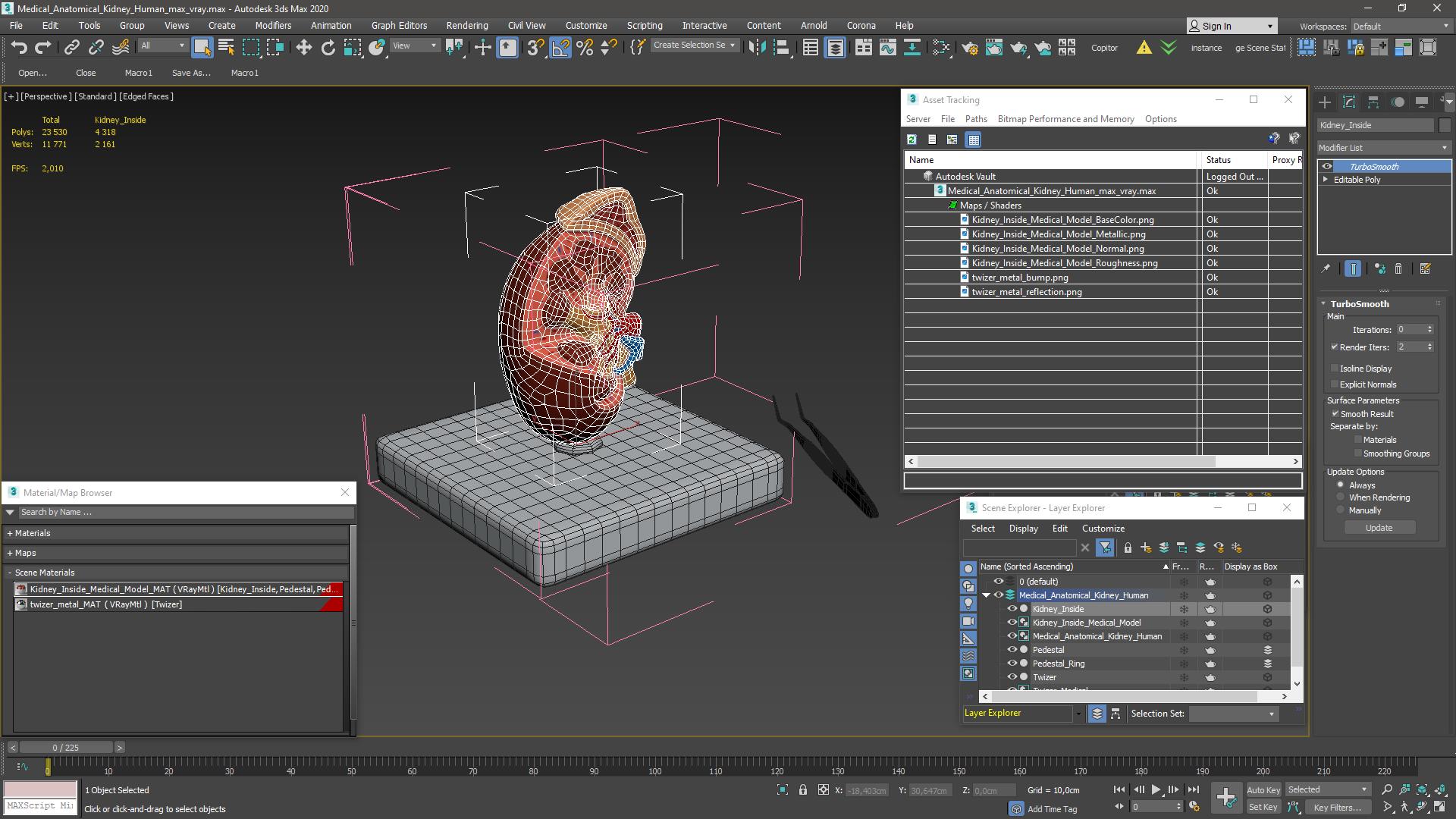 Medical Anatomical Kidney Human for 3D Print 3D model