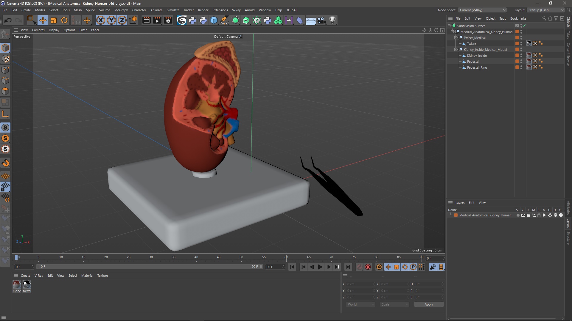 Medical Anatomical Kidney Human for 3D Print 3D model