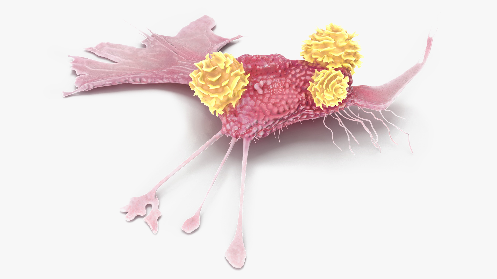 3D model Cancer Cell with 3 Lymphocytes