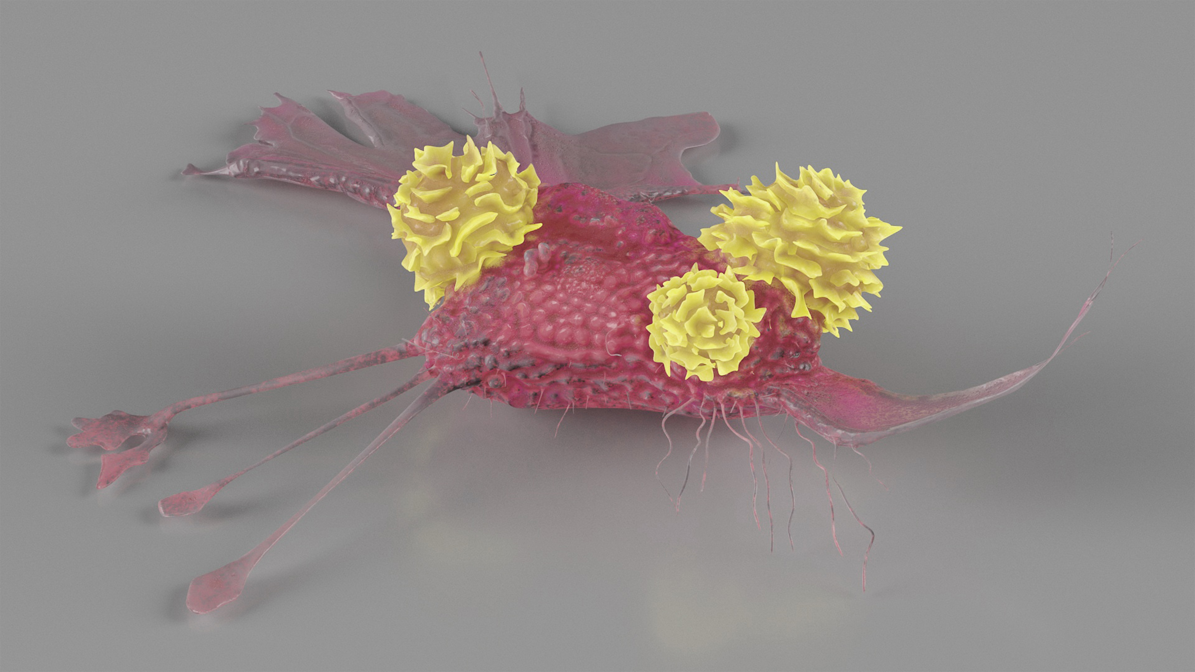 3D model Cancer Cell with 3 Lymphocytes