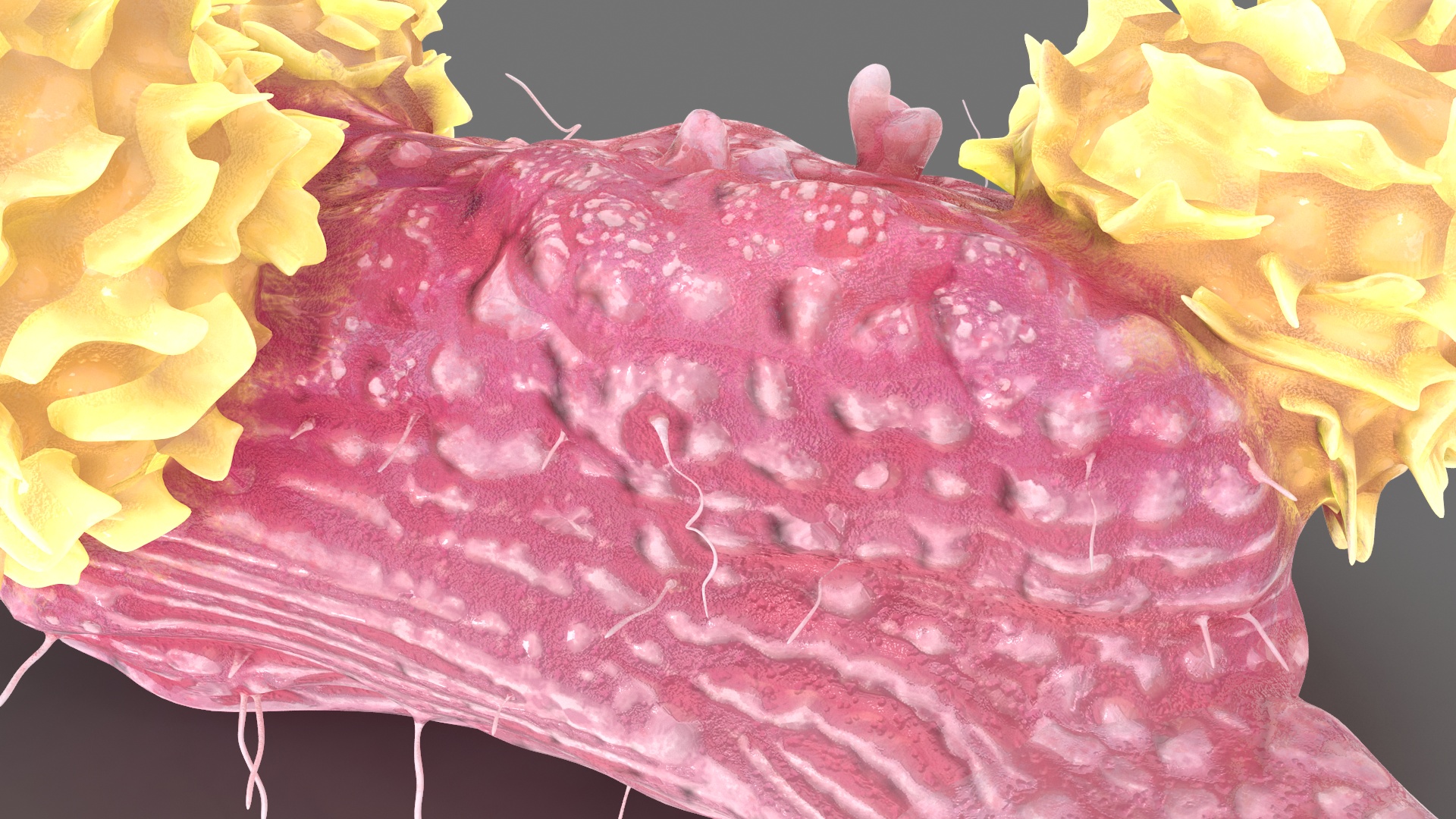 3D model Cancer Cell with 3 Lymphocytes