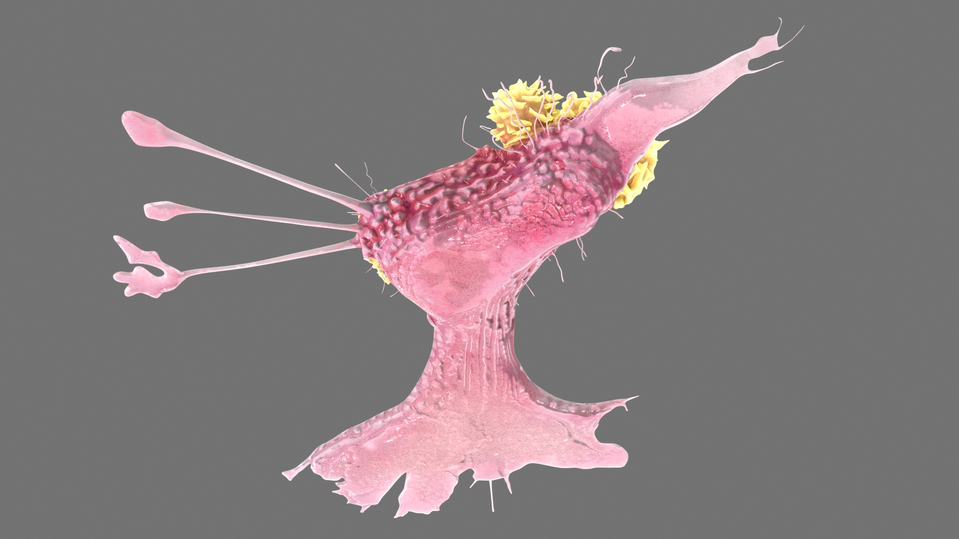 3D model Cancer Cell with 3 Lymphocytes