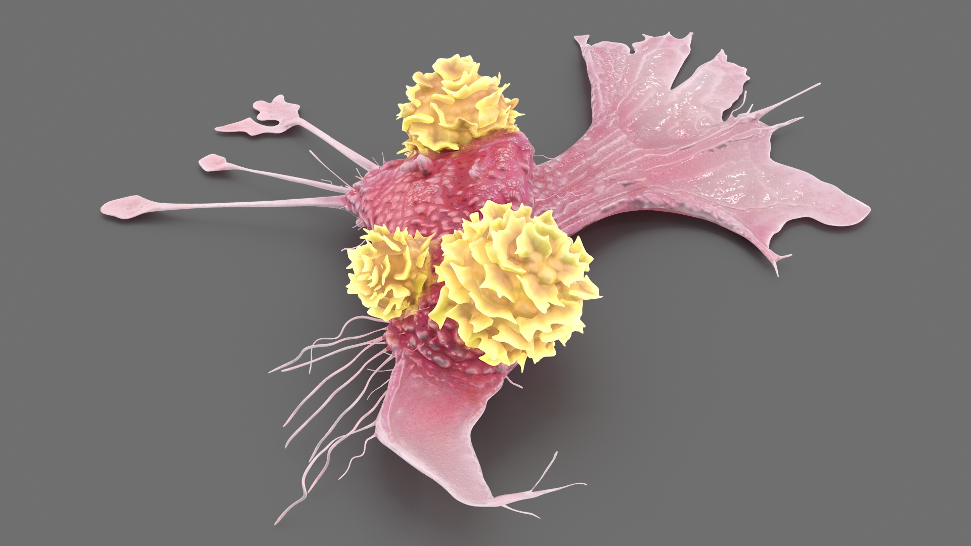 3D model Cancer Cell with 3 Lymphocytes