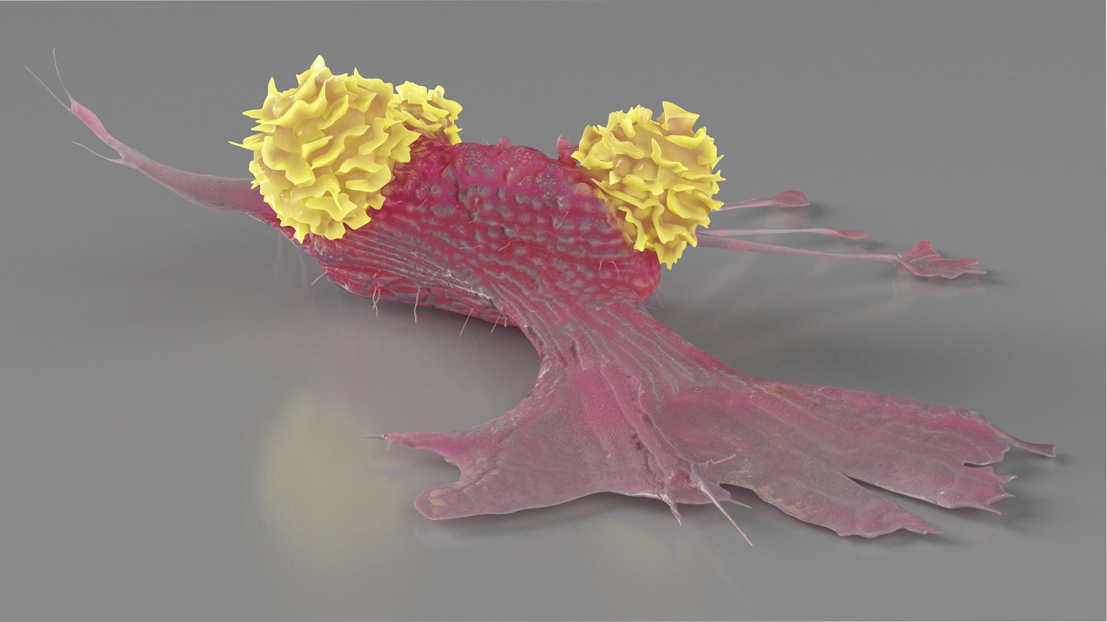 3D model Cancer Cell with 3 Lymphocytes