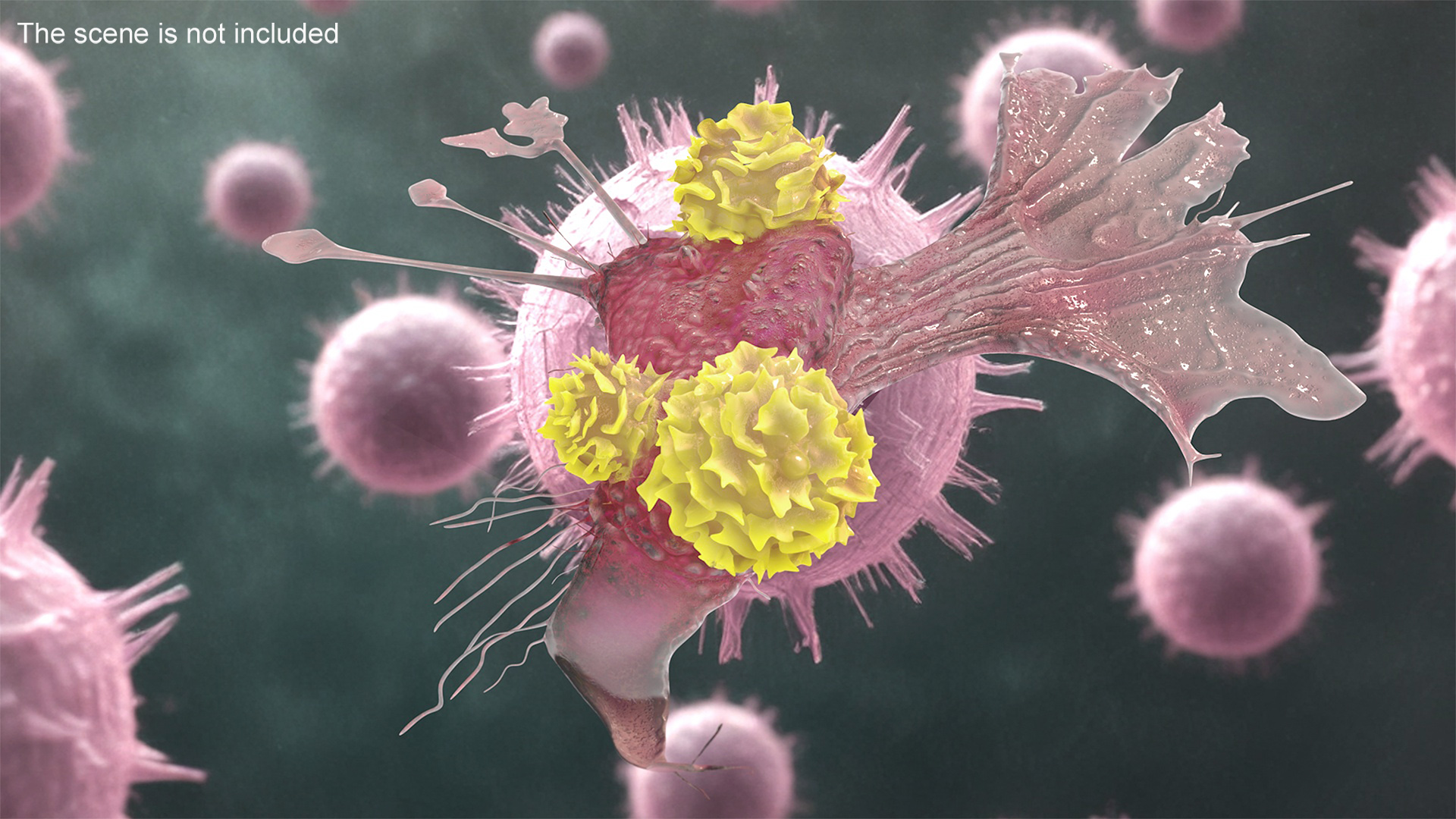 3D model Cancer Cell with 3 Lymphocytes