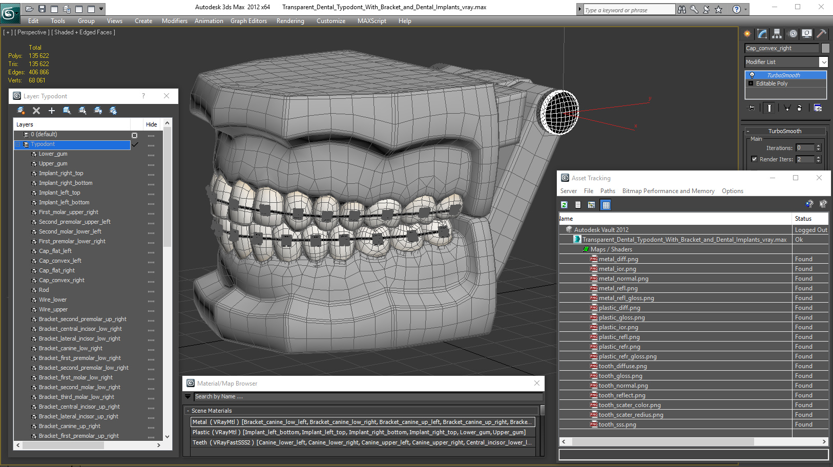 3D model Transparent Dental Typodont With Bracket and Dental Implants