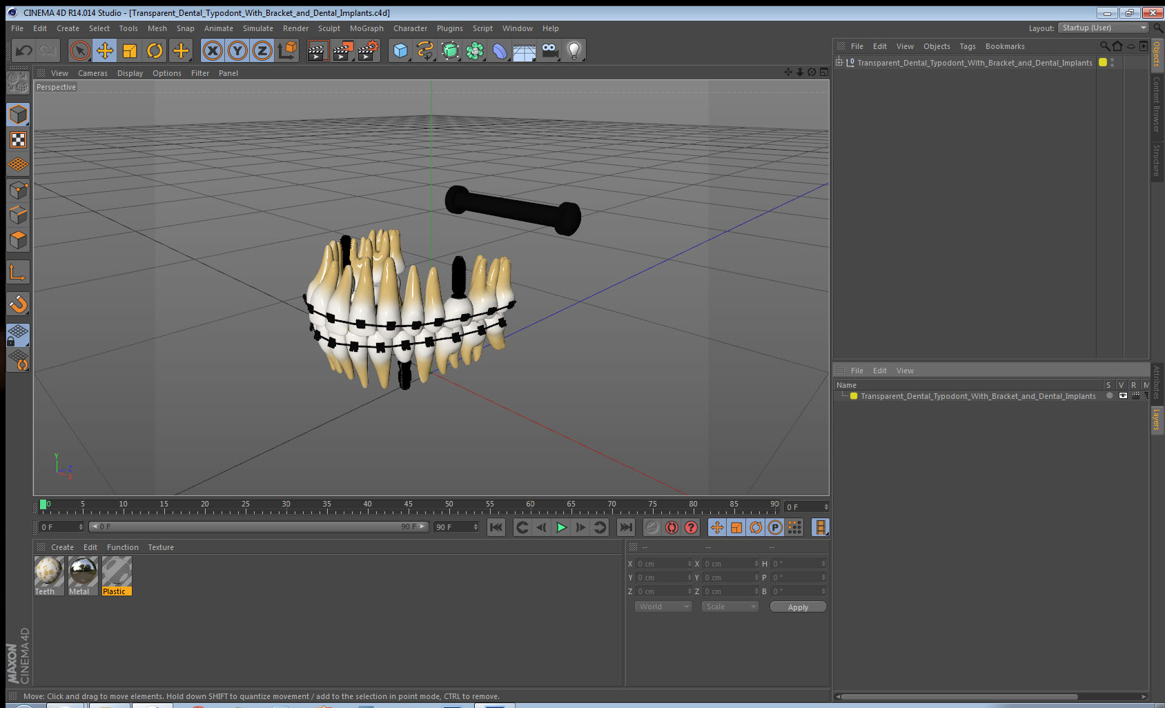 3D model Transparent Dental Typodont With Bracket and Dental Implants