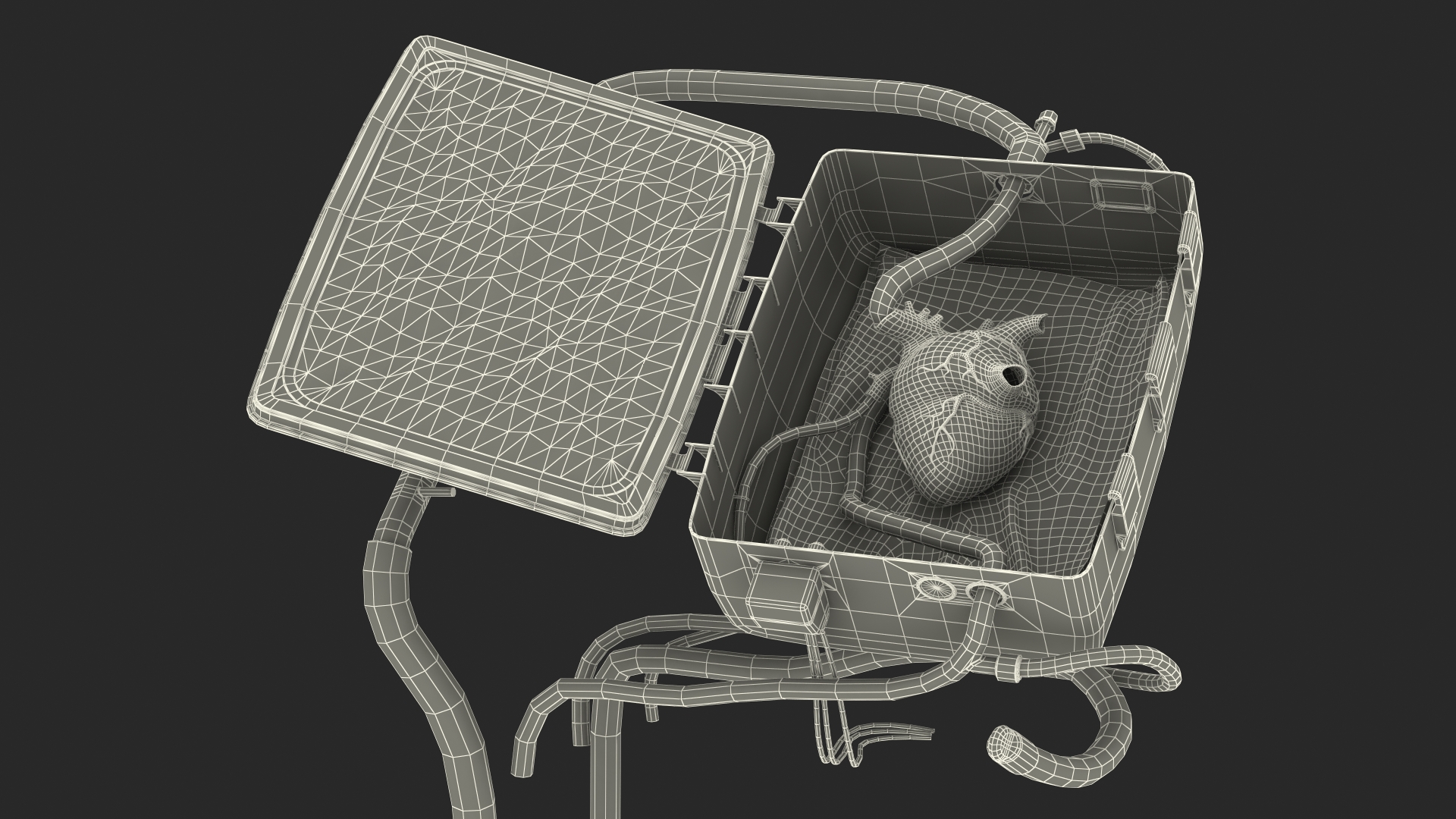 3D Heart in Organ Care Box model