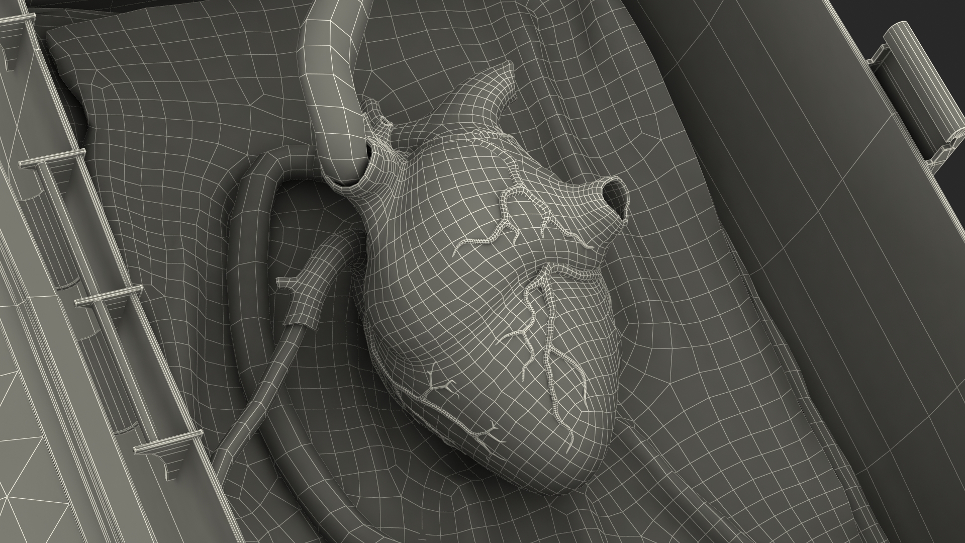 3D Heart in Organ Care Box model